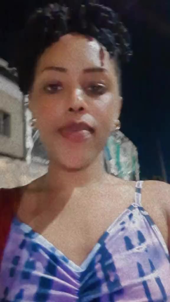 @Prossy