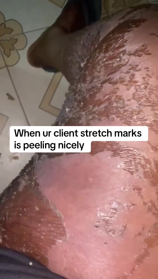 @@ Precious peeling soap