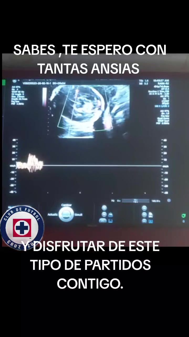 @g&uuml;ero Azul