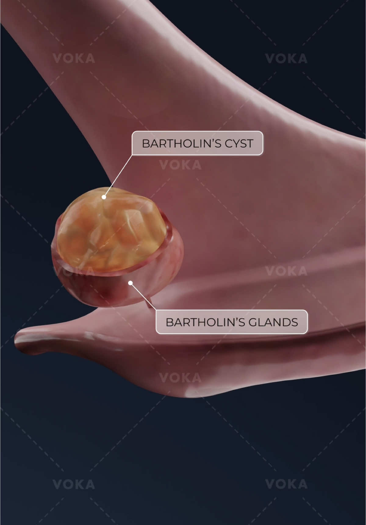@VOKA 3D Anatomy & Pathology