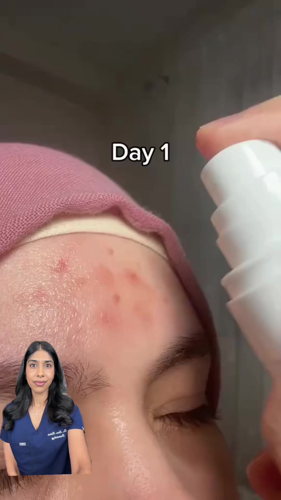 @Dr. Neera, Skin Surgeon