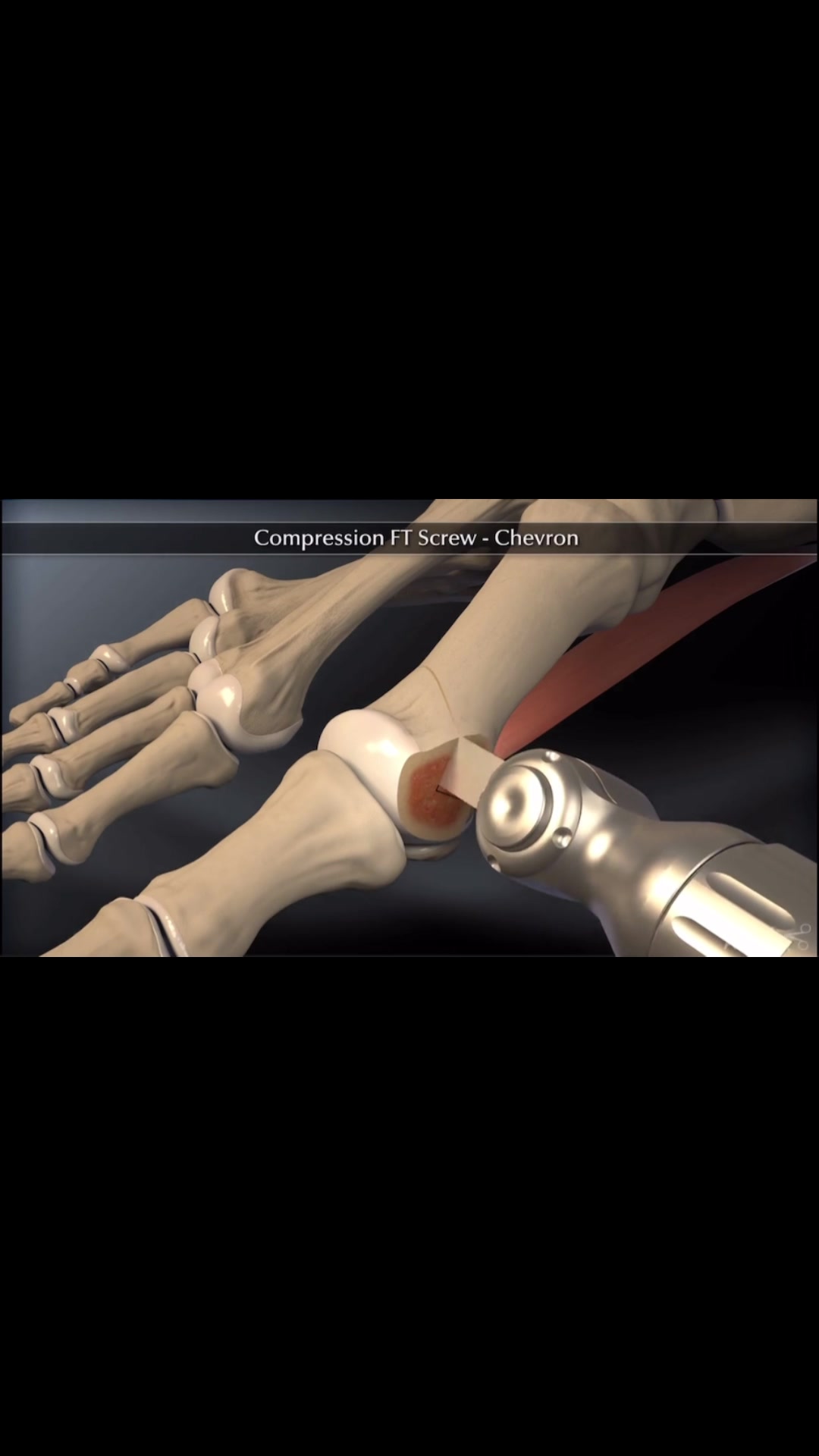 @Anatomias
