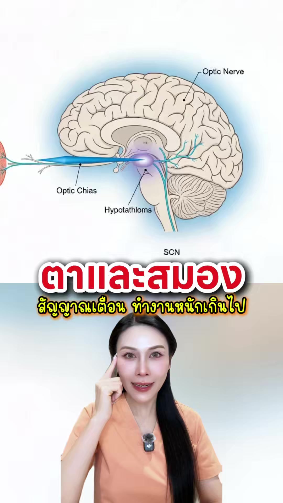 @พยาบาลอัญ