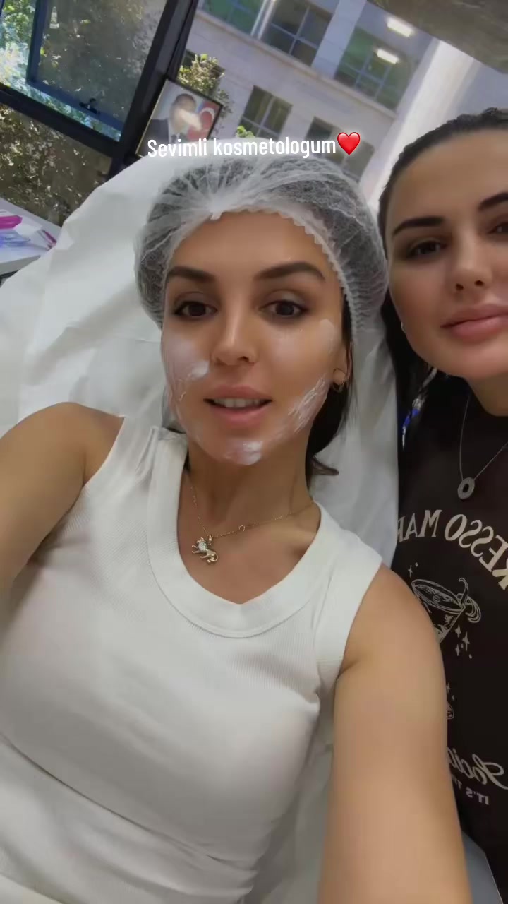 @Sevil Aliyeva