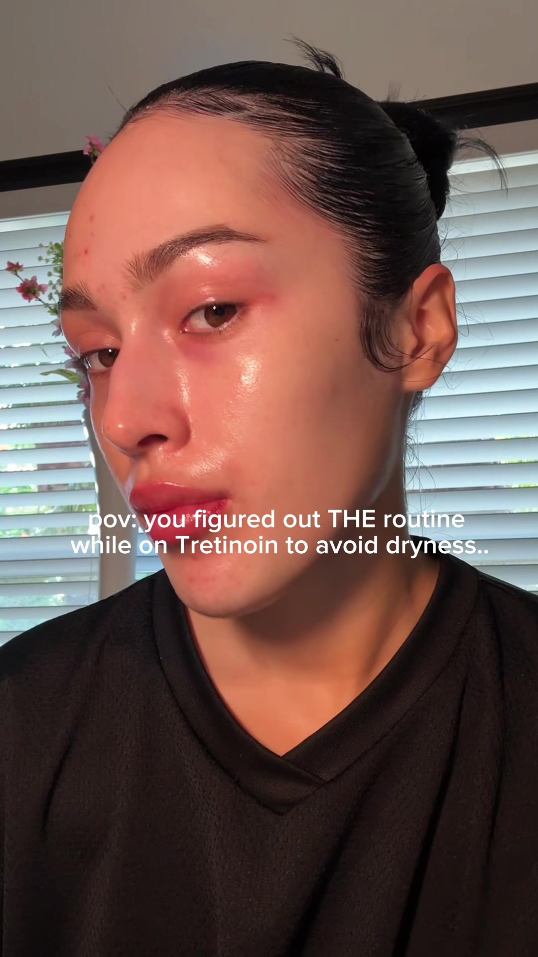 @Xilee