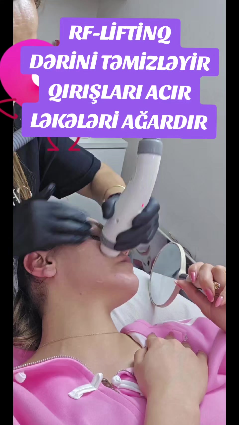 @ehmedli_kosmetoloq_lazeroloq