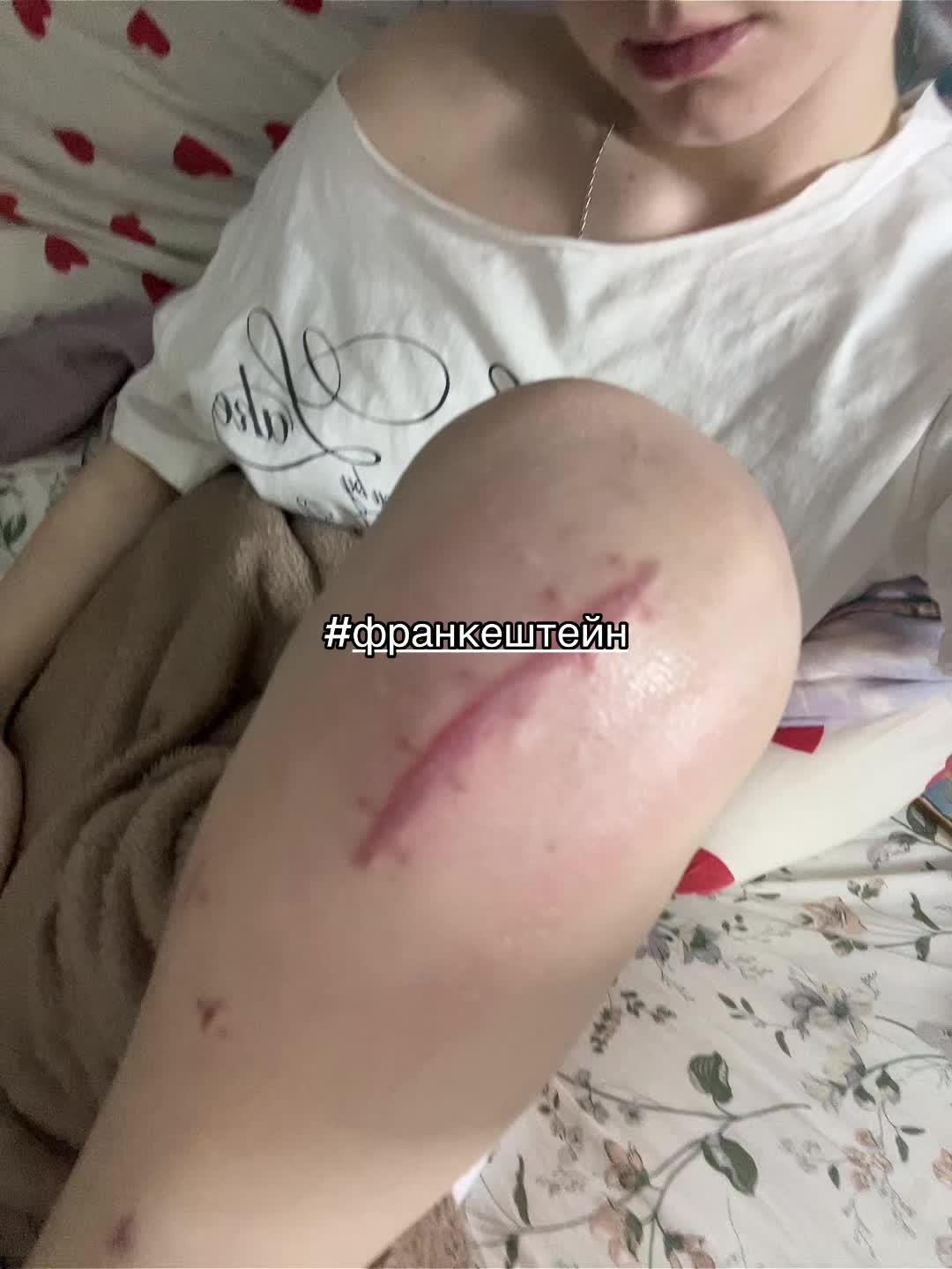 @xilen