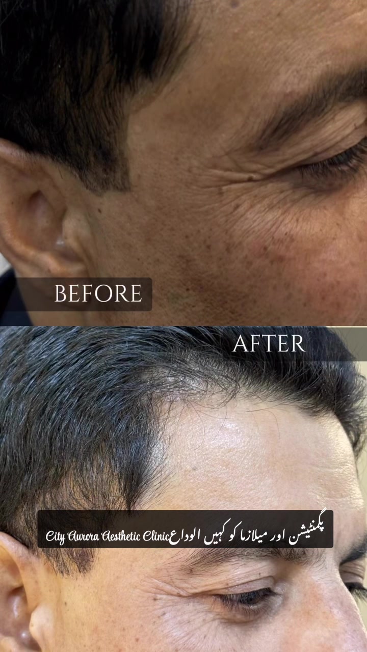 @City Aurora Asthetic clinic