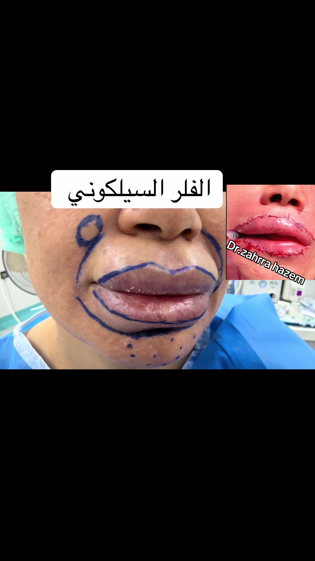 @الدكتورة زهراء حازم