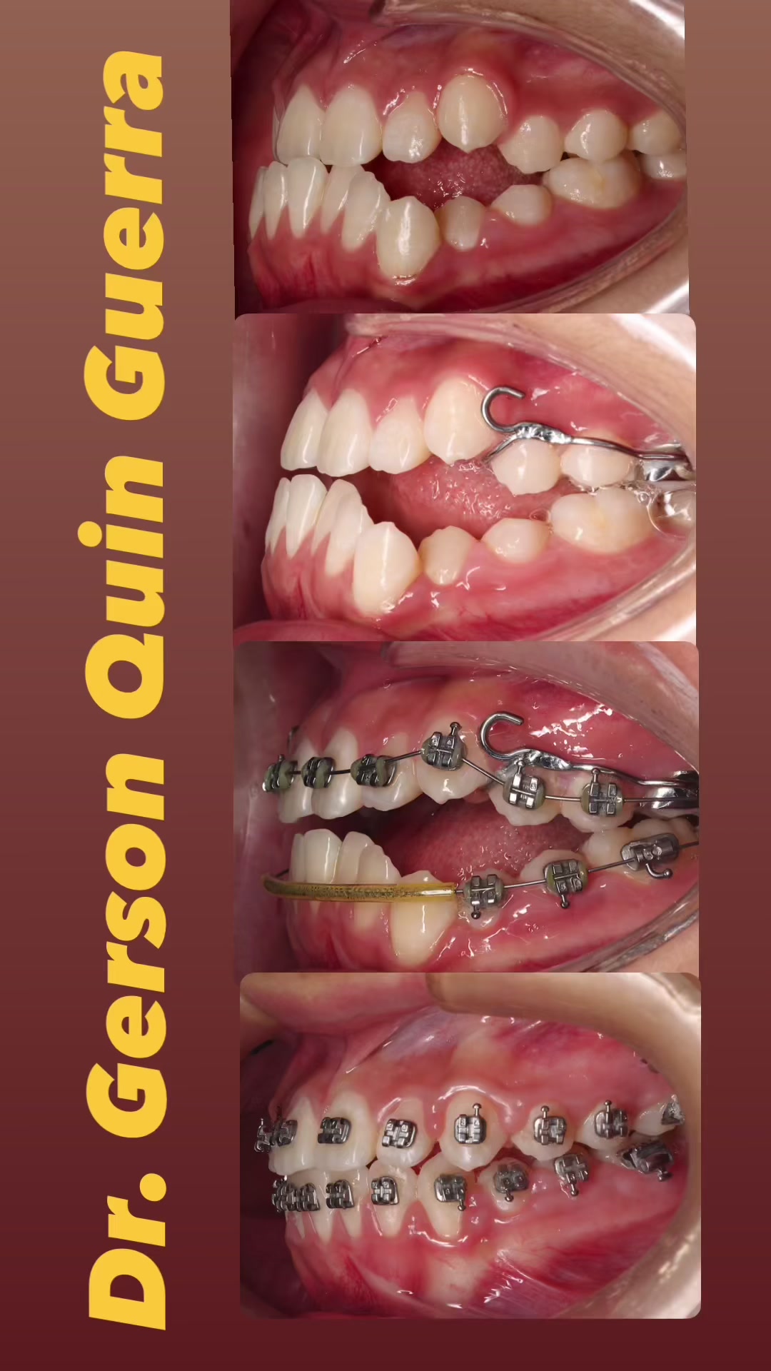 @Dr. Gerson Quin Guerra, PhD