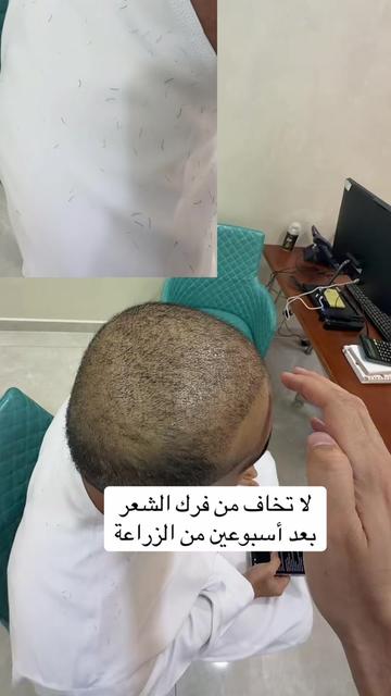 @Dr. Ahmed Alkhateeb