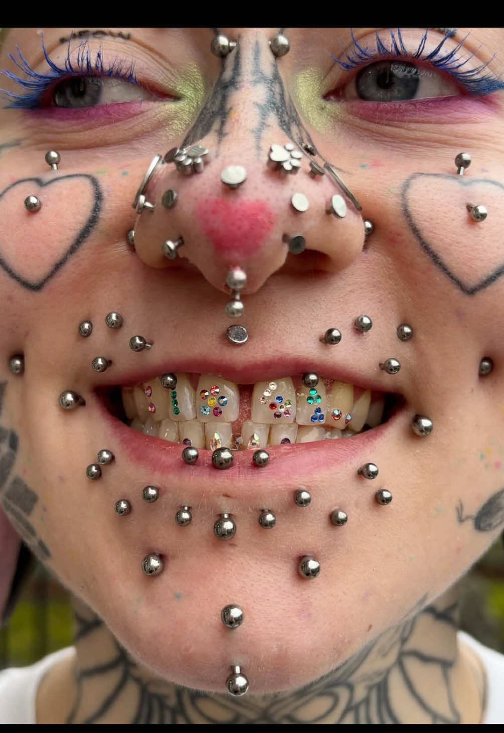 @🤮