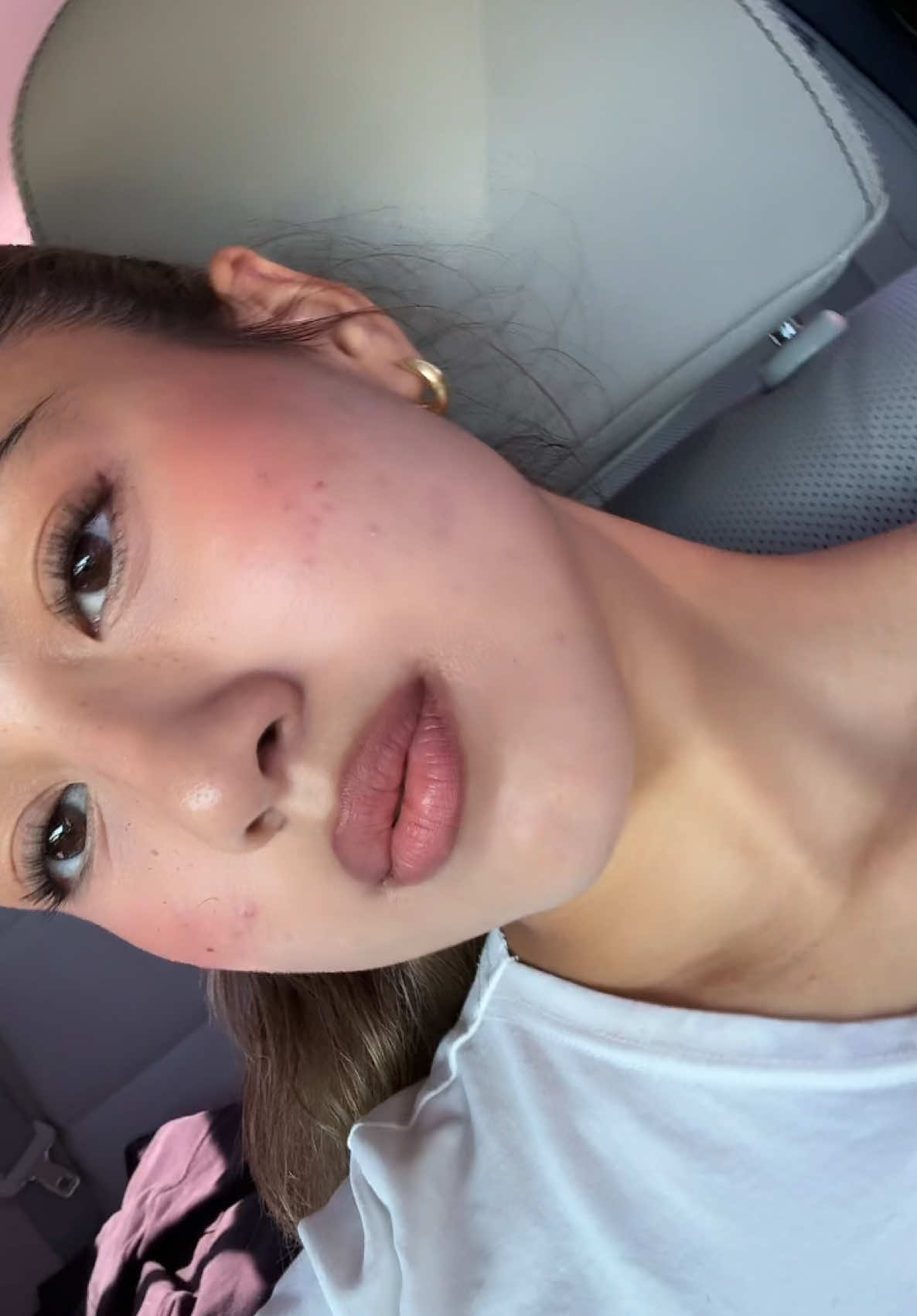 @Emily Alvarez