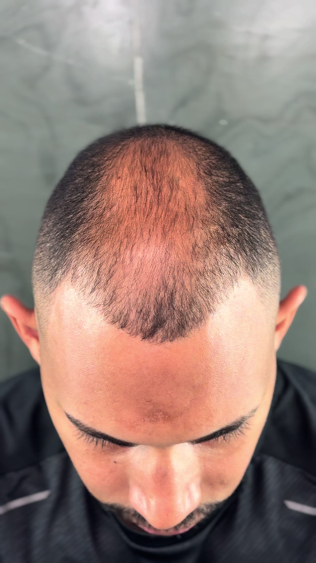 @Valesca Abi Ackel Scalp