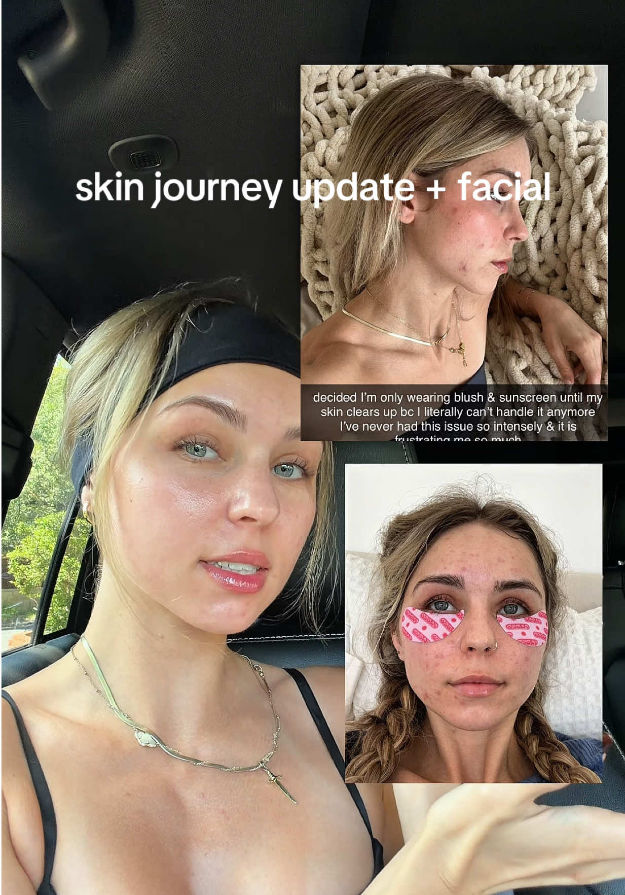@Lauren J