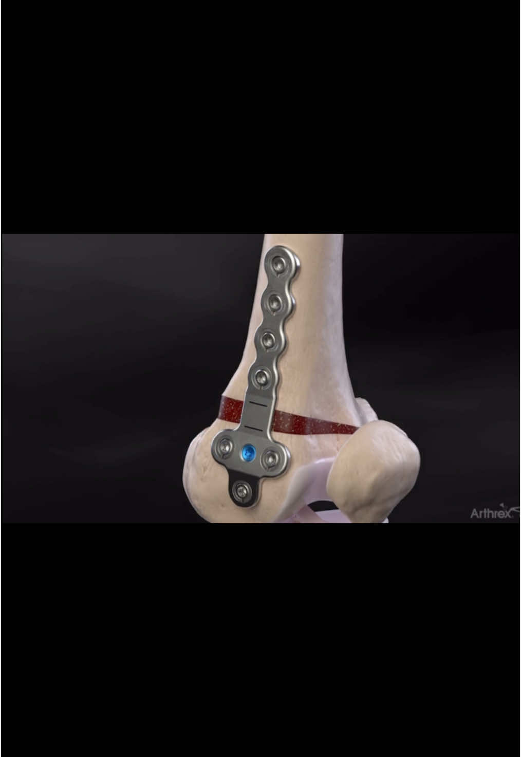 @Anatomias
