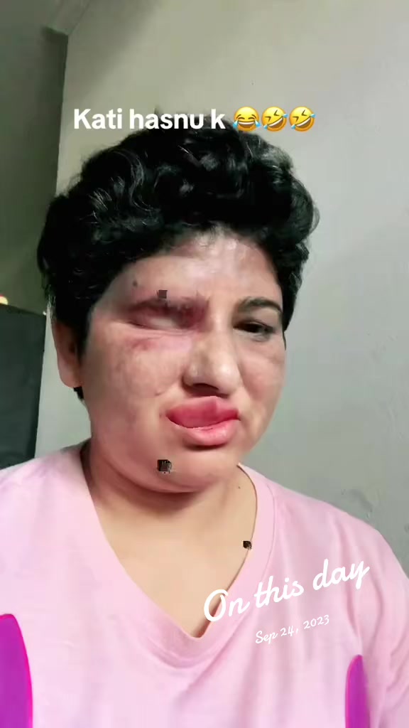 @Yashu