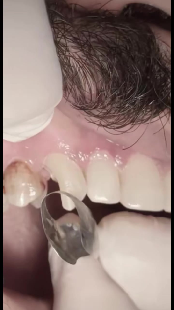 @Dr_sheraz_official 🦷