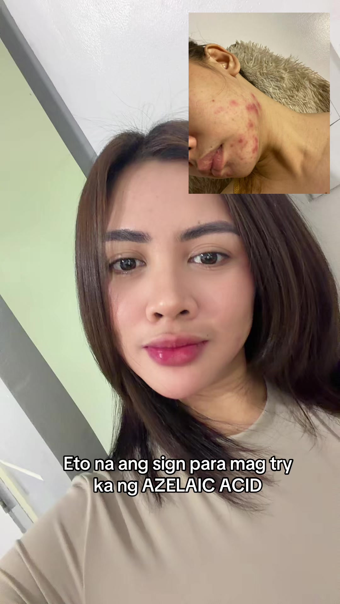 @Ally Feedback Ph