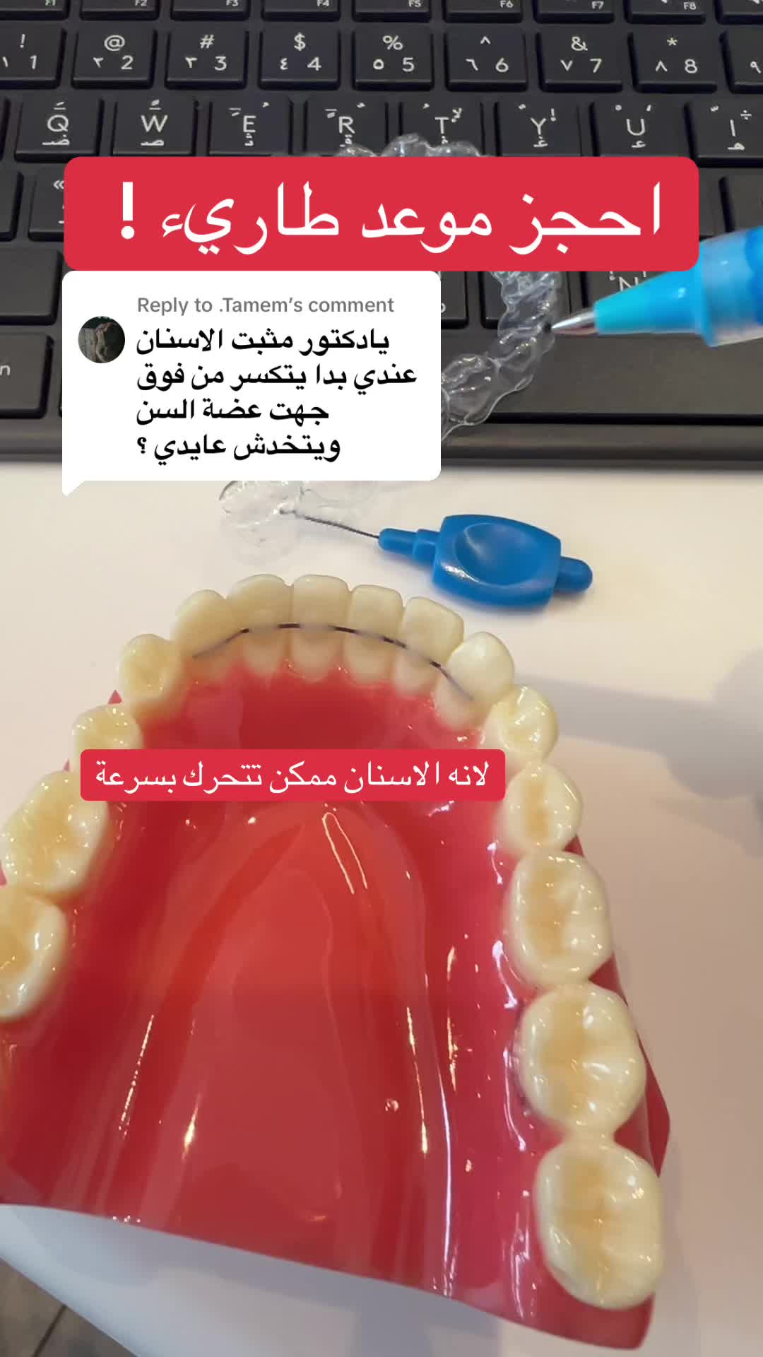 @د. أسامة أحمد | تقويم أسنان