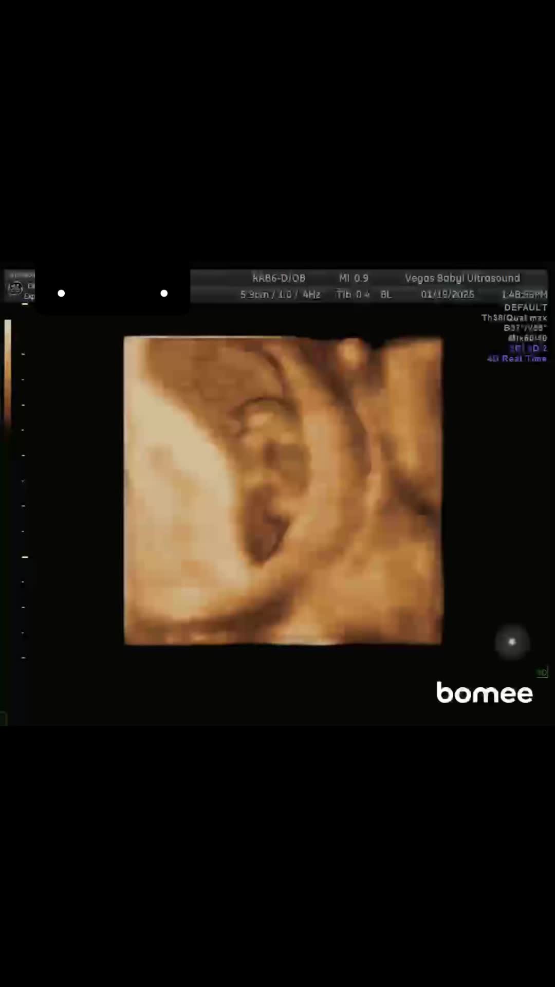 @laceyxdubs