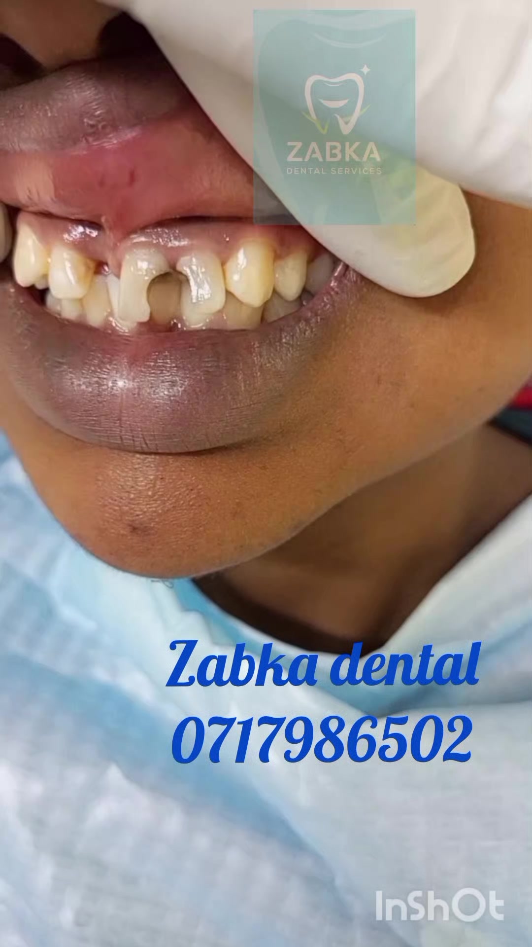 @Zabka Dental
