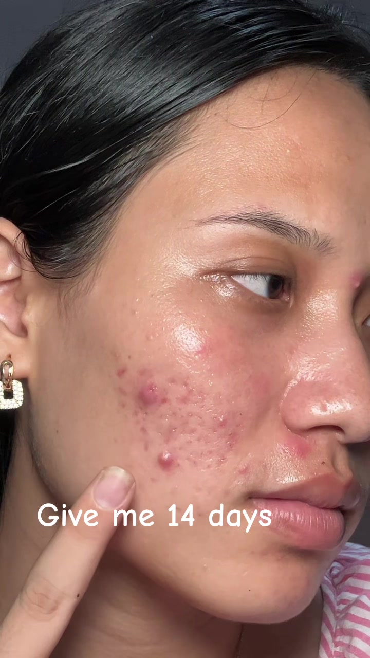 @Styleandskinbysanju