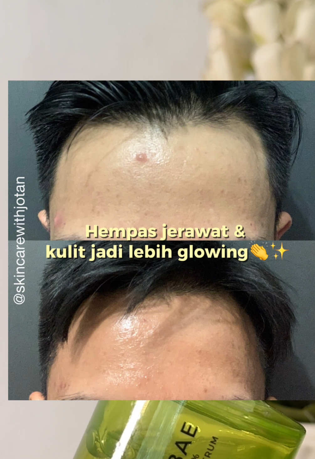 @Avoskin Beauty