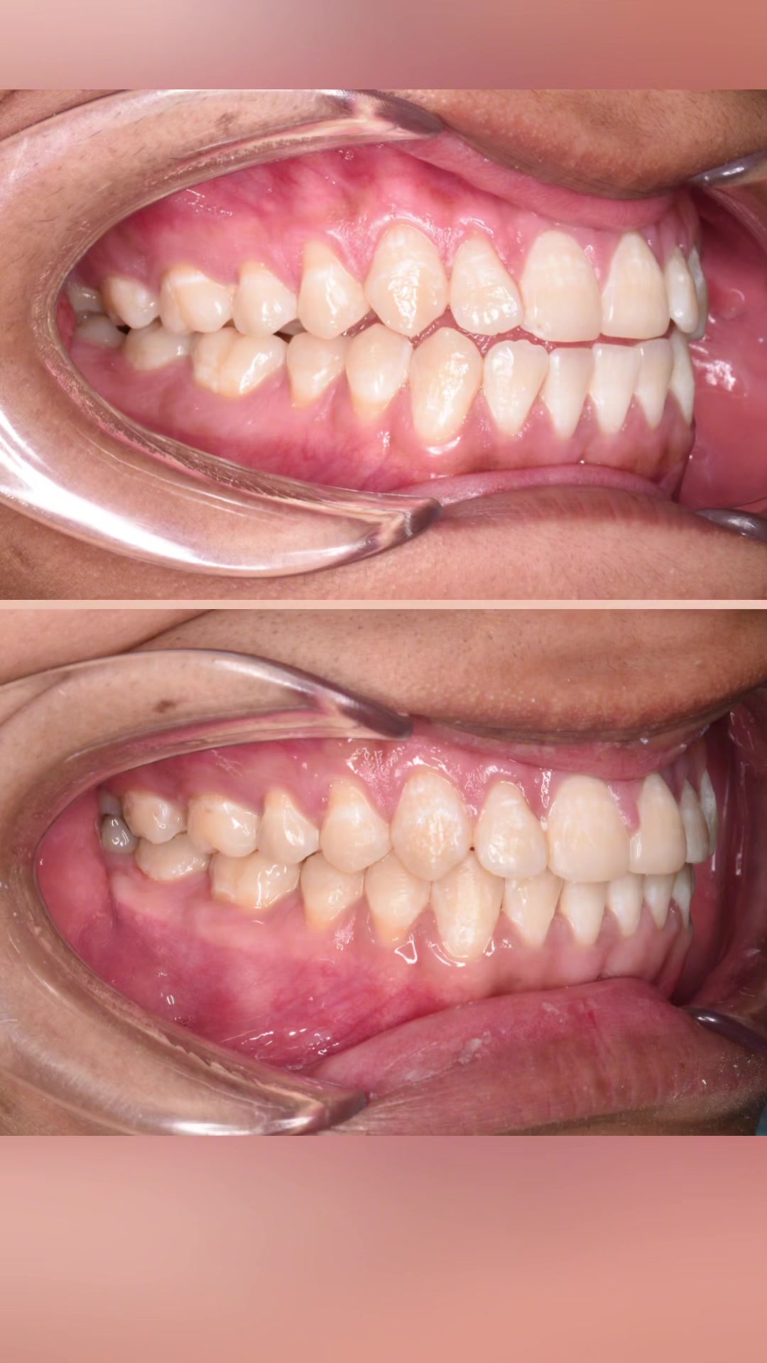 @DentikaBrackets