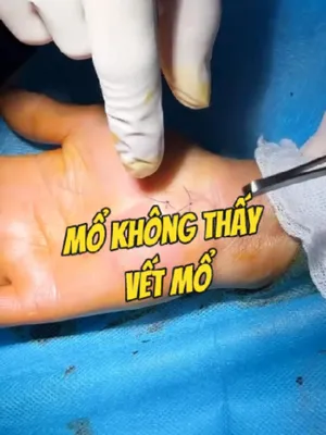 @Chuyên gia xương khớp