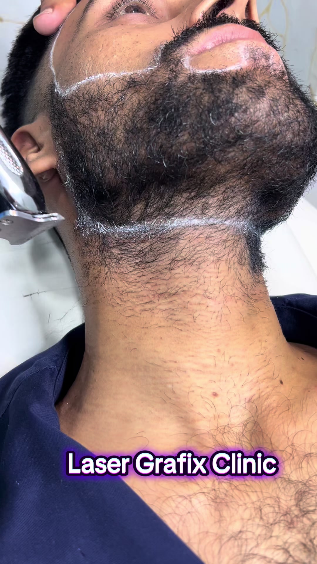 @Laser Grafix clinic