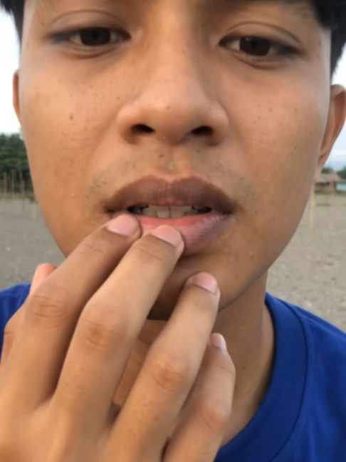 @ArunikaCare