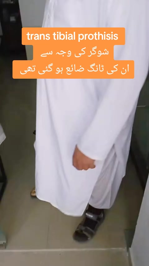 @مصنوعی اعضاء