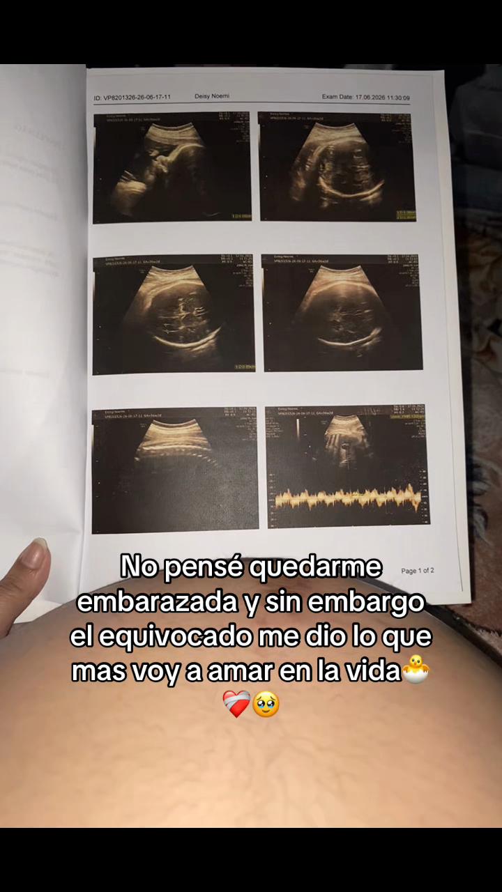 @Dei🖕🏻