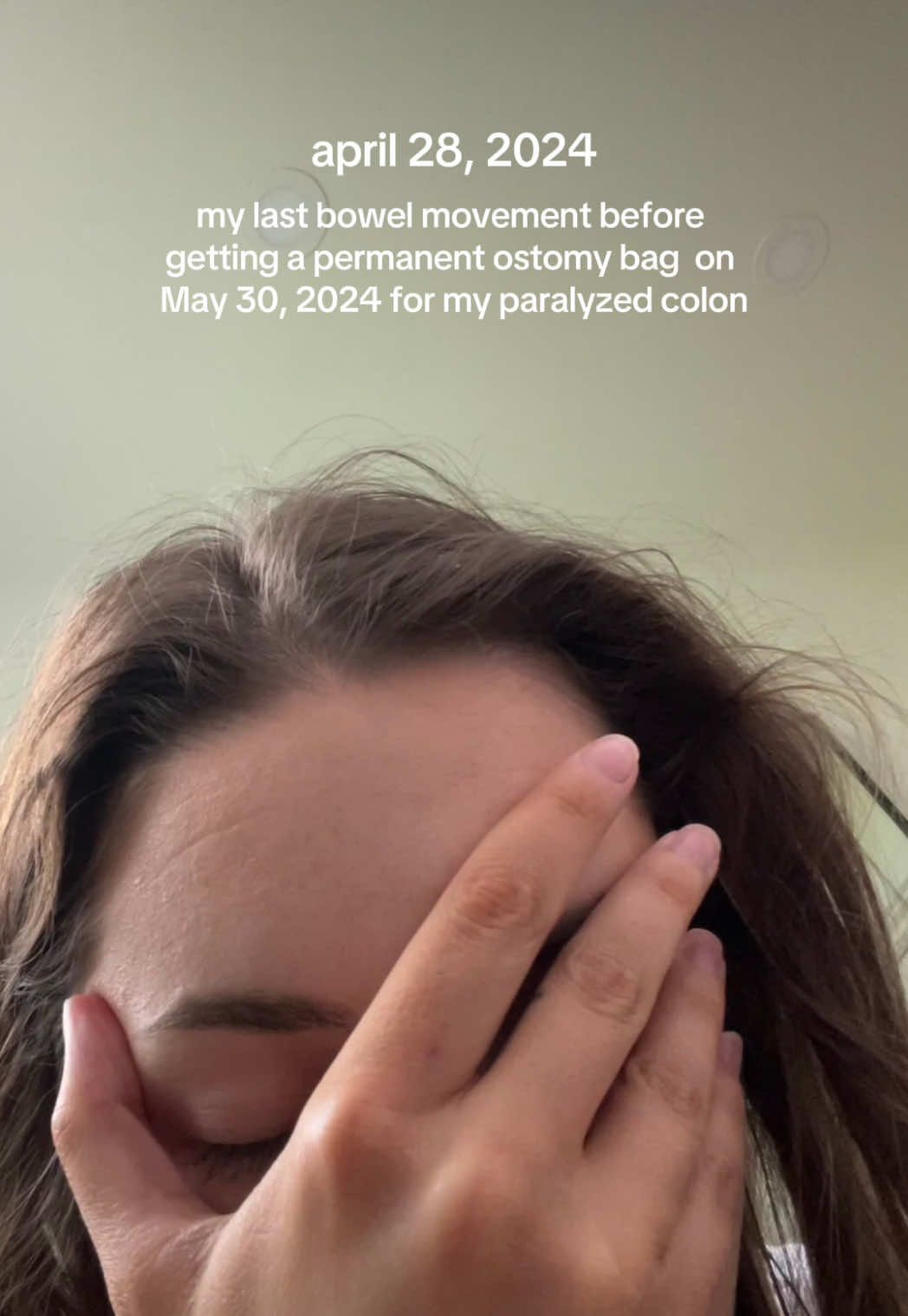 @distaaybled