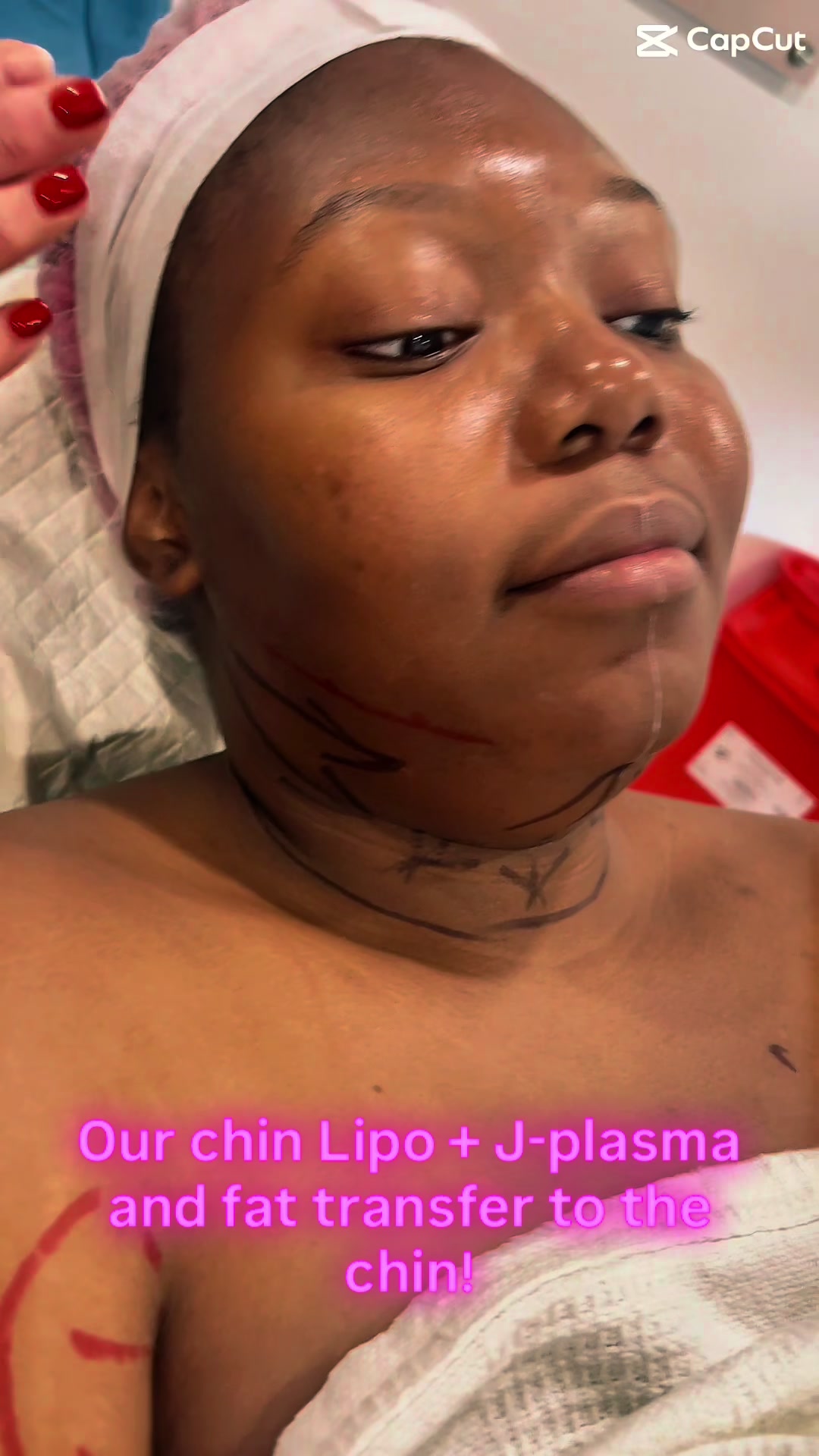 @BioAesthetic305