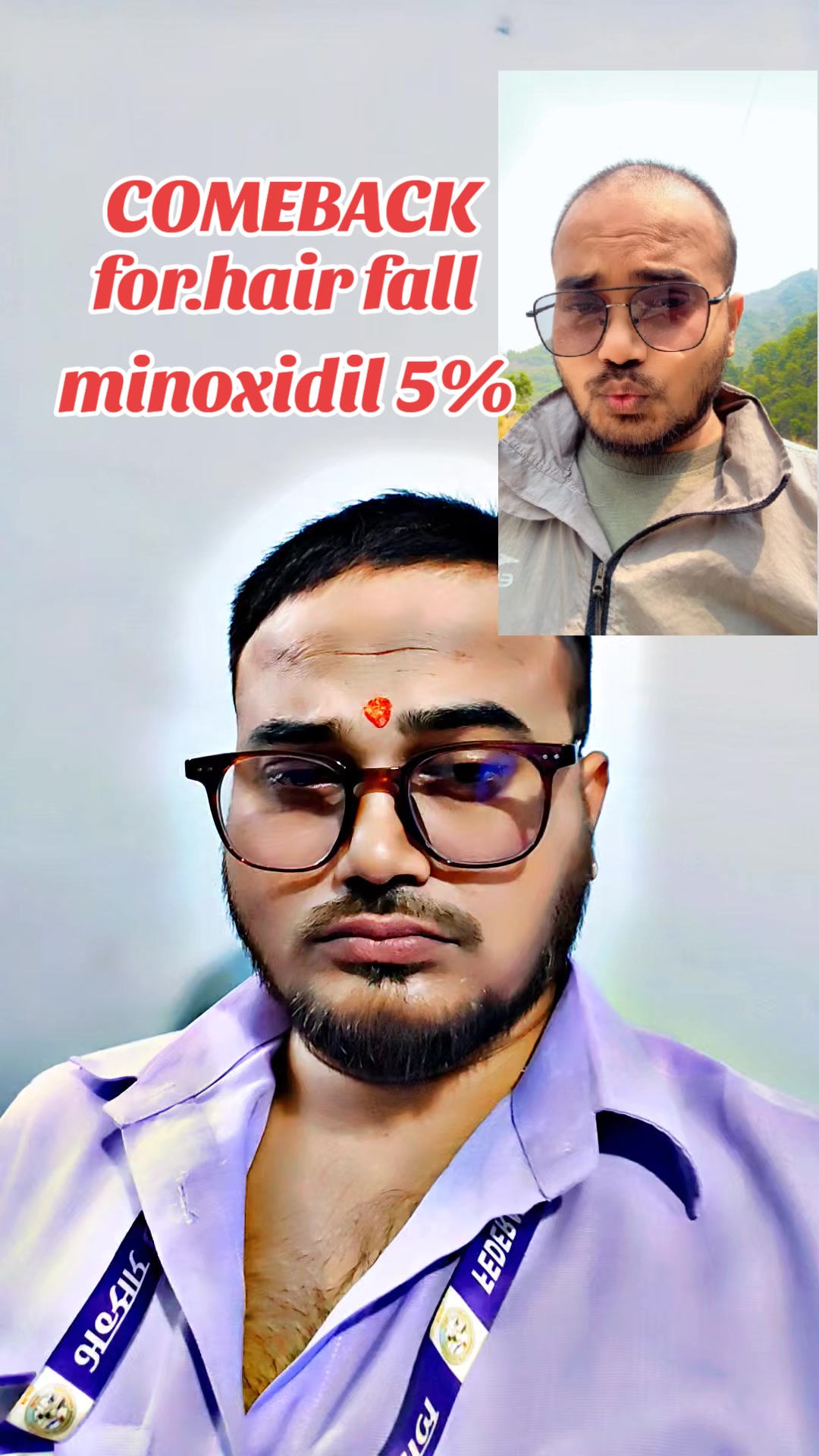 @DipeshSingh. 🕸🕷