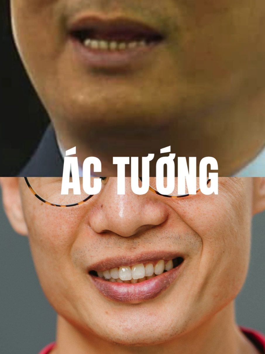 @Nh&acirc;n tướng học - Steven