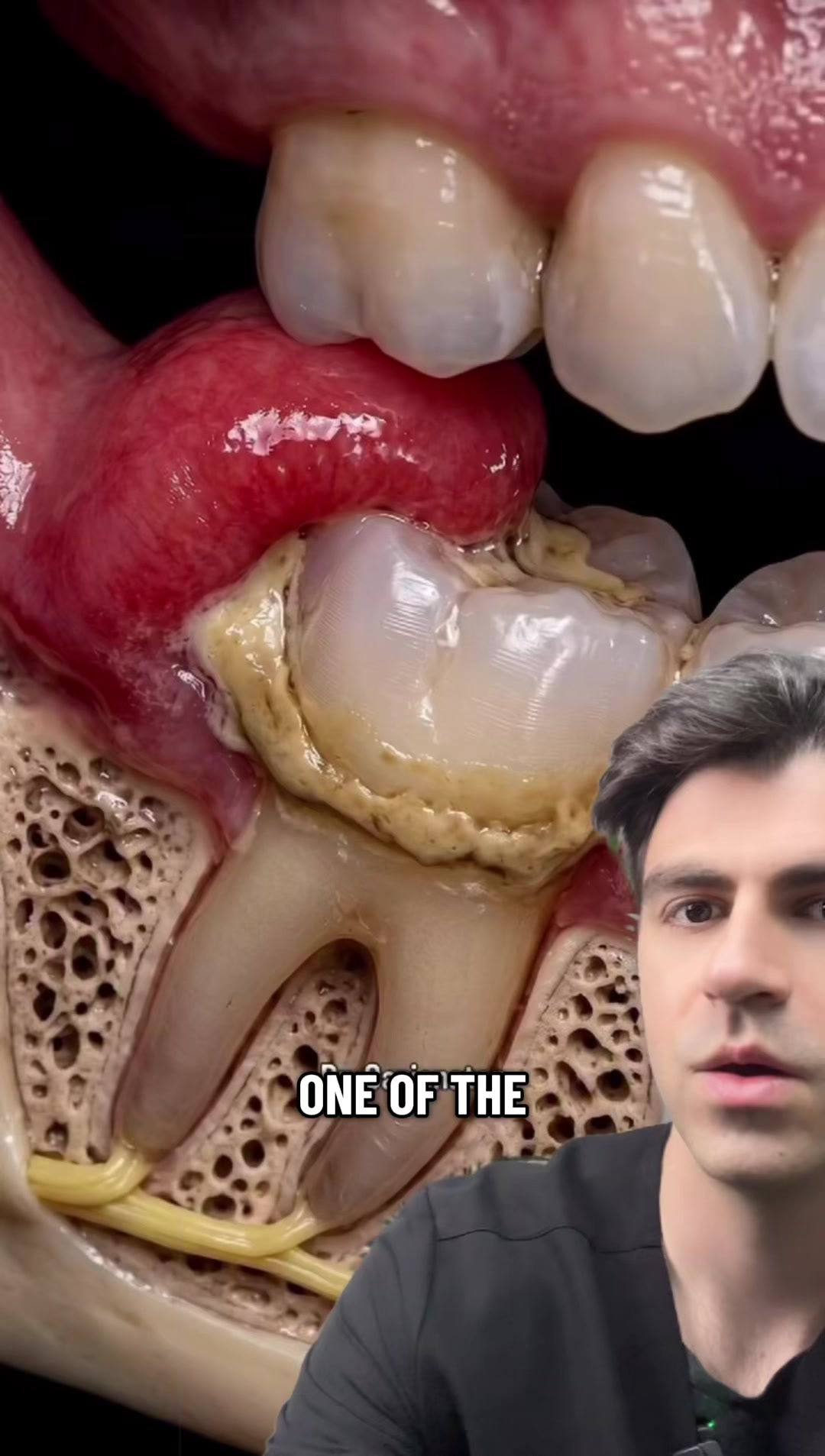 @Dr. Kadish