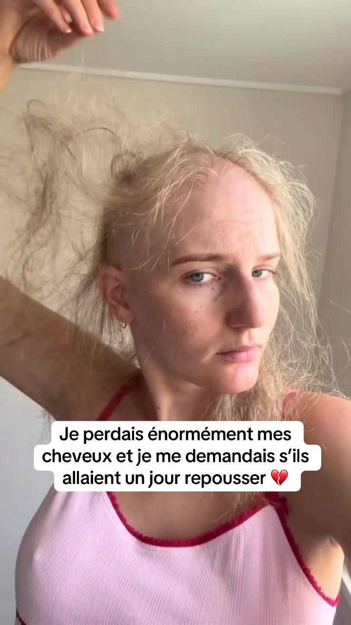 @Lux’Hair Growth