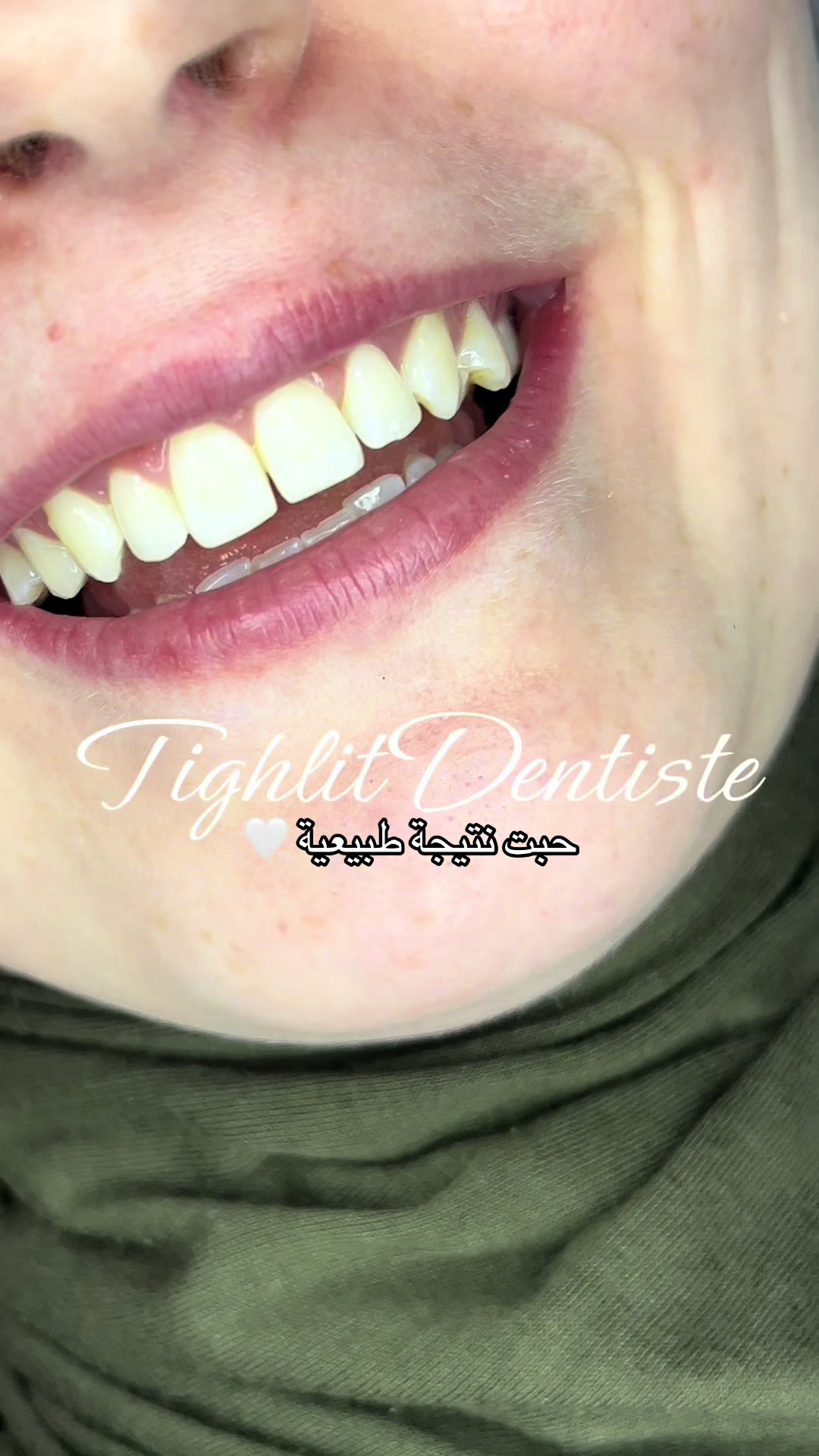 @tighlit_dentiste🦷