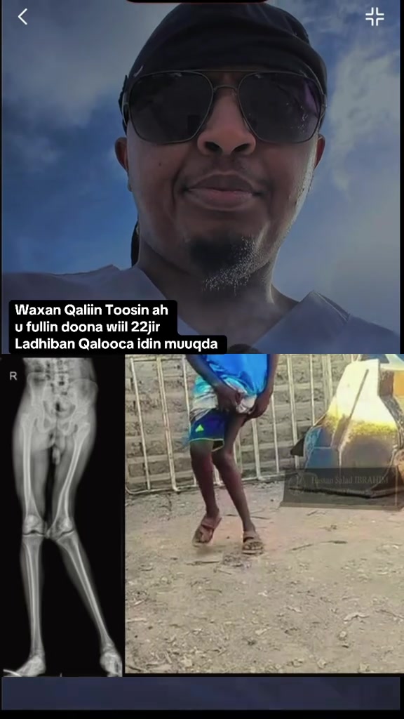 @DrHassan Fidow