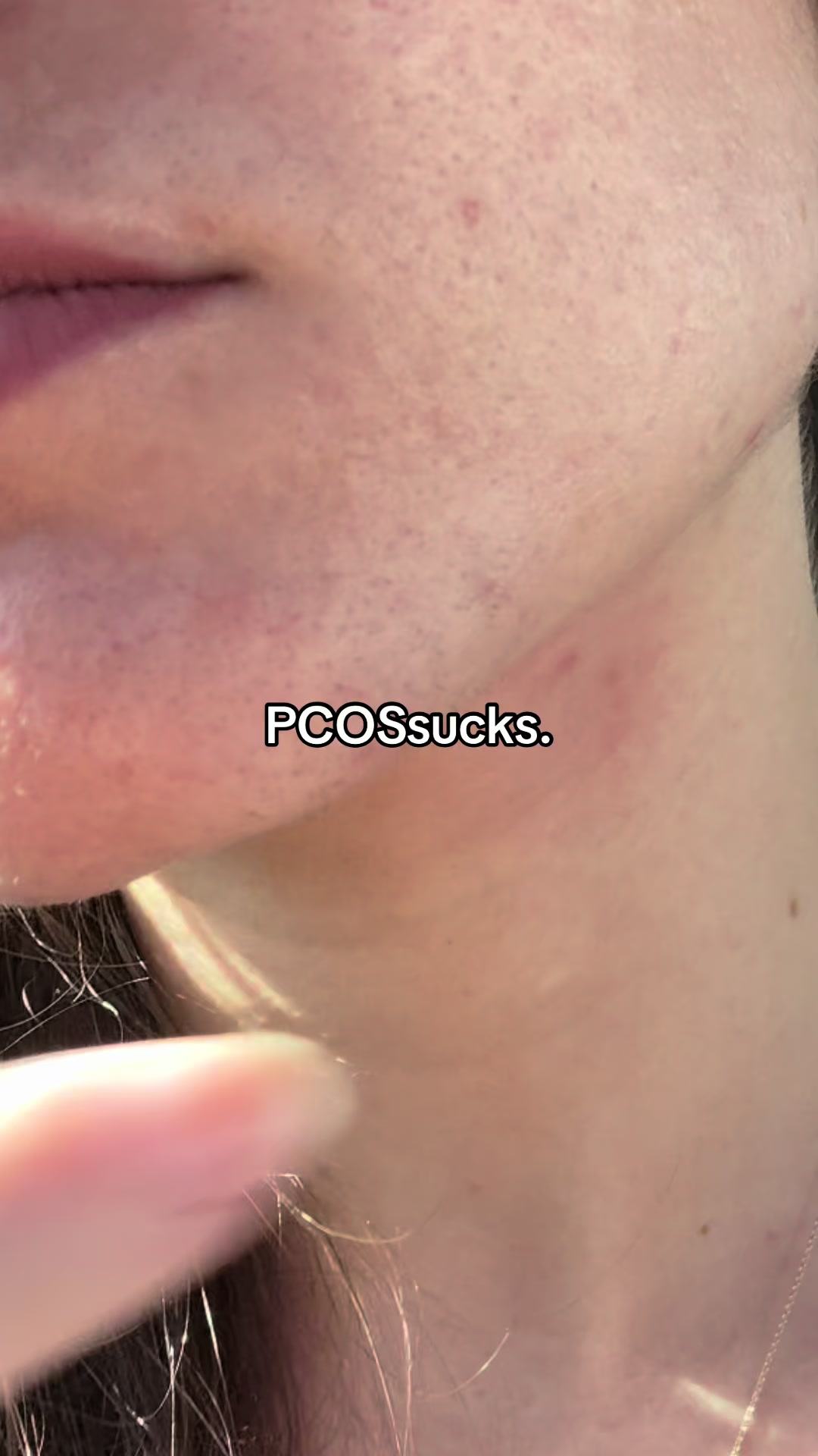 @Sarah | PMOS/PCOS life + tips