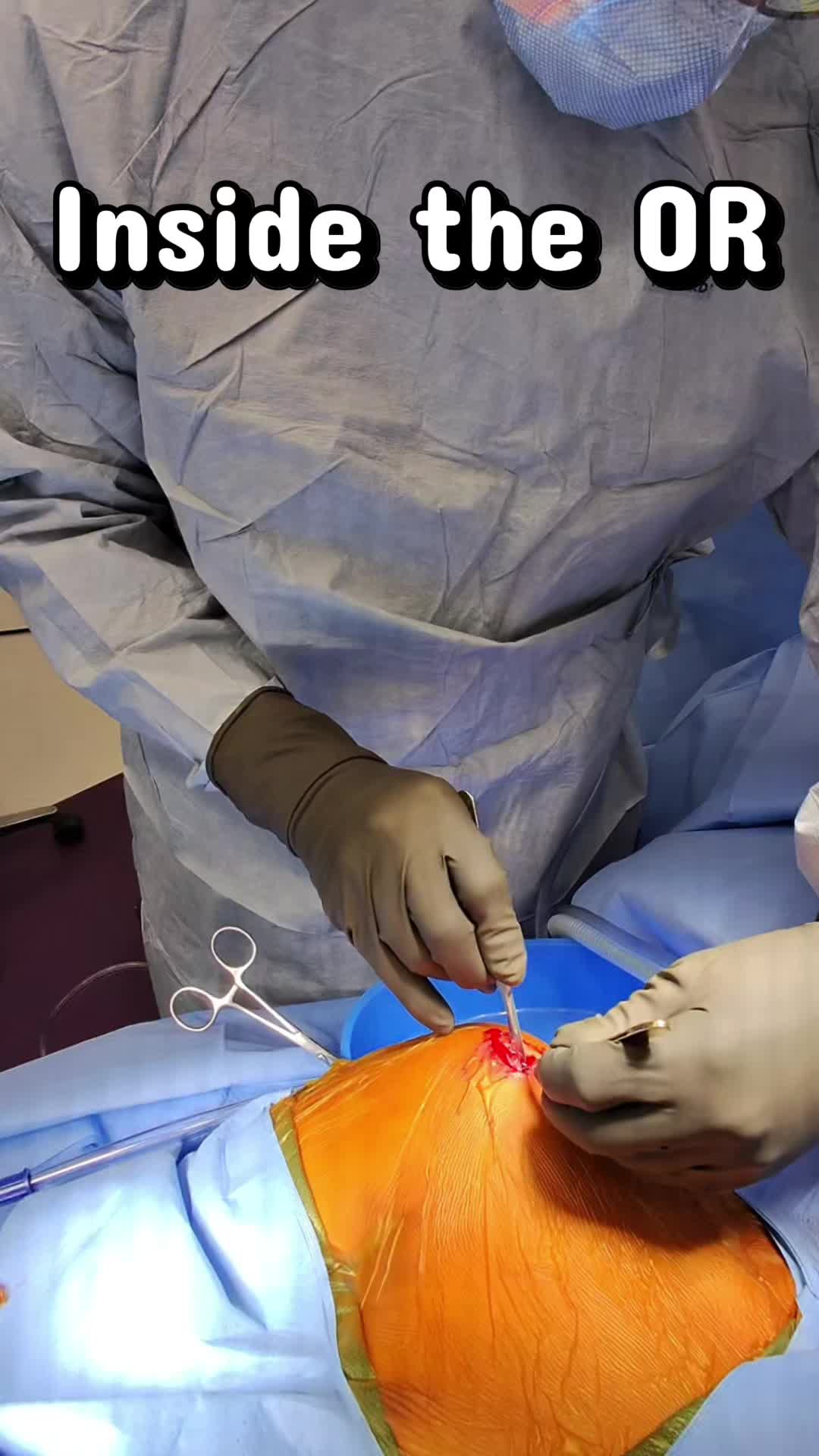 @Ortho POV