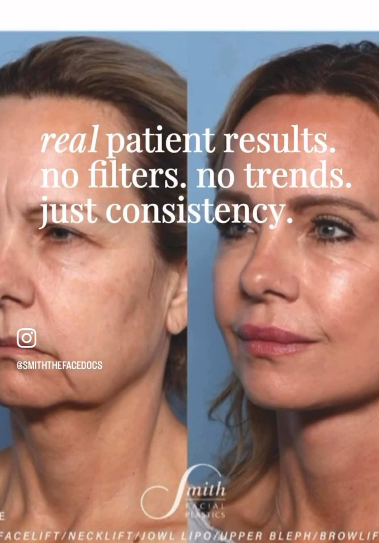 @Smith Facial Plastics
