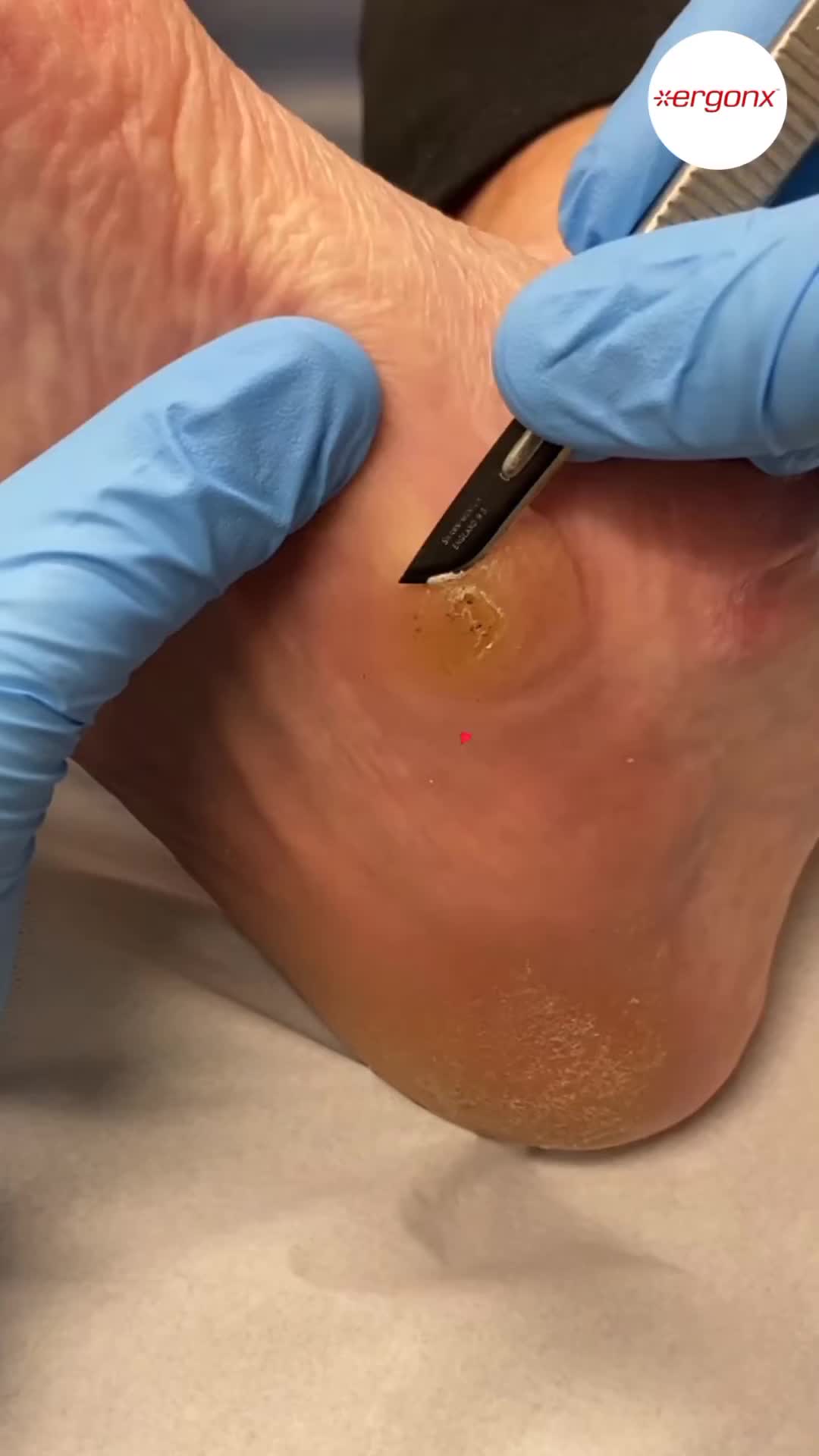 @ergonx