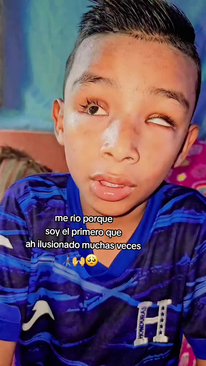 @👨🏽🦯➡️Dilan niño ciego💧