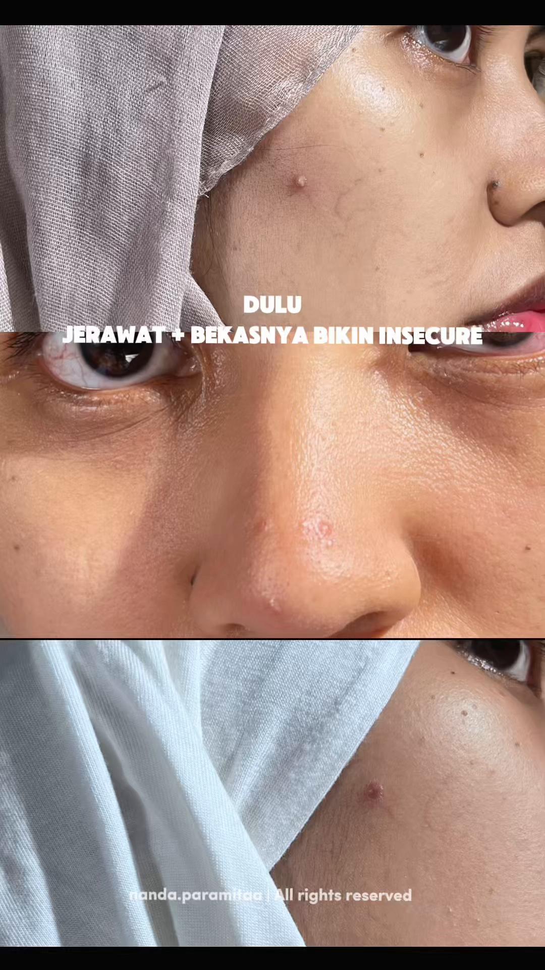 @Nandaparamita