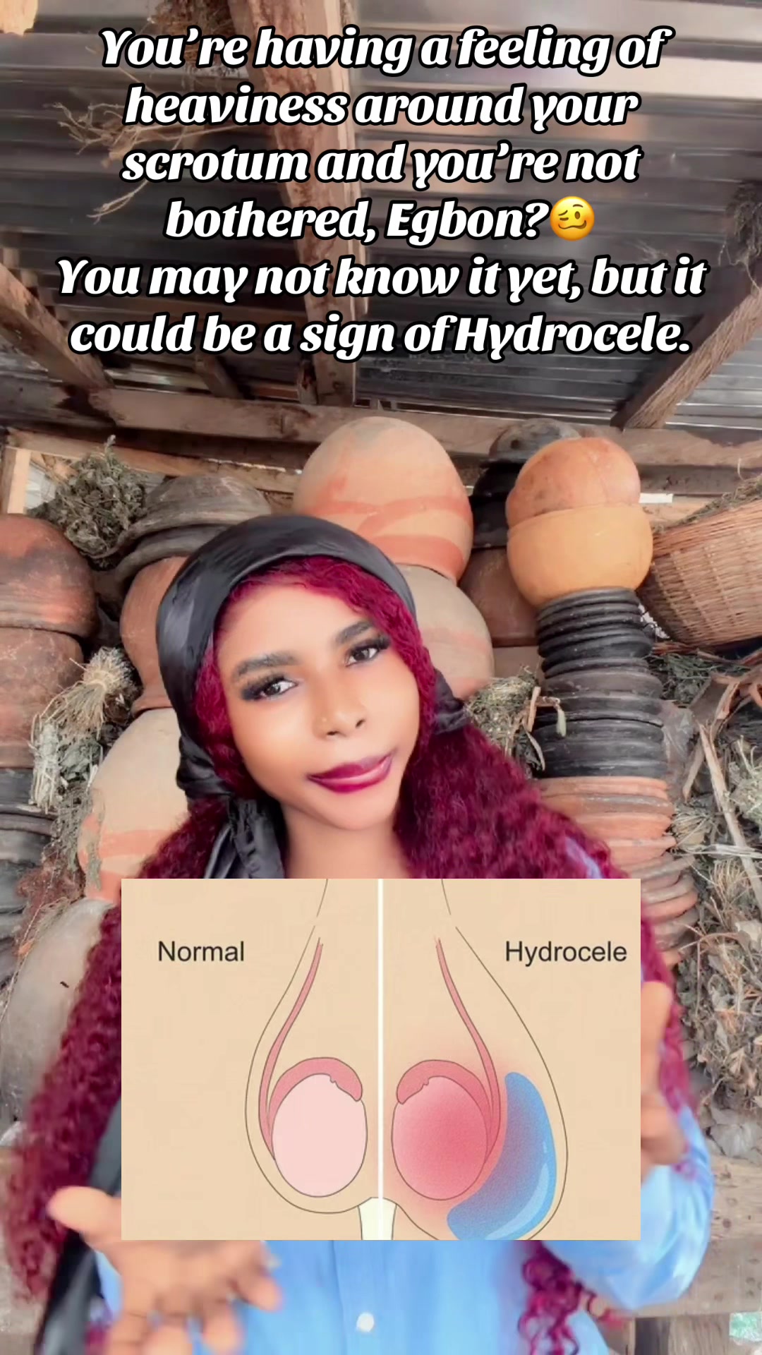 @GeNz_alagbo🐍🍯