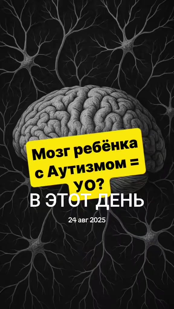 @Neuroway®